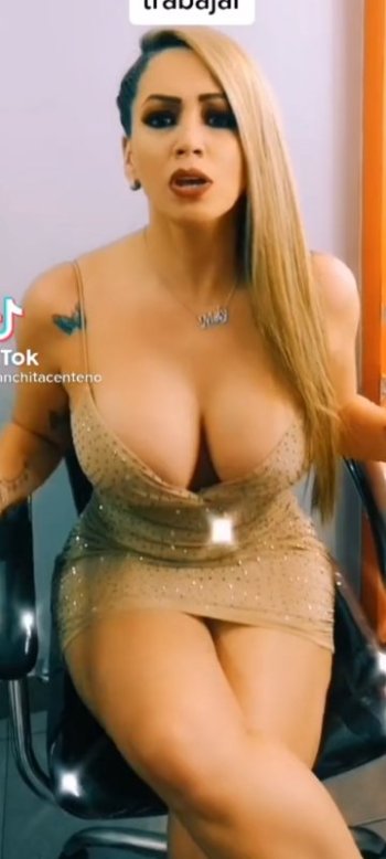 Screenshot_2021-10-18-15-16-52-192_com.miui.gallery.jpg Screenshot_2021-10-18-15-16-52-192_com.miui.gallery.jpg